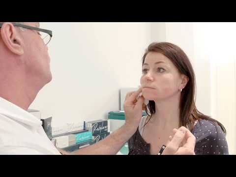 Video: Fadenlifting an Gesicht und Wangen
